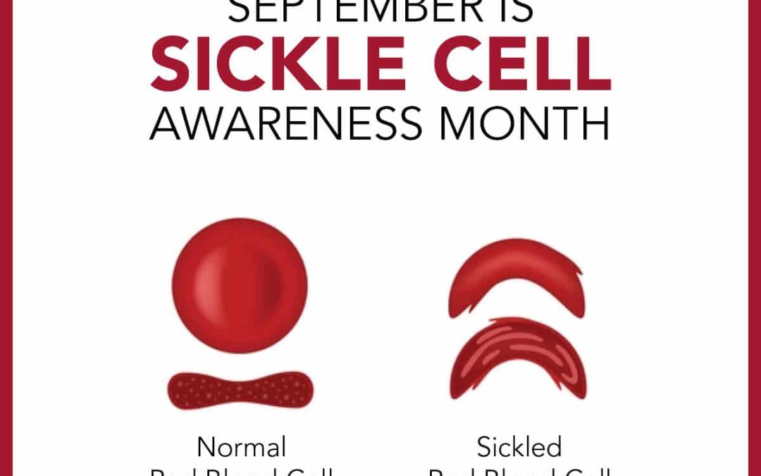 Sickle Cell Disease and Social Security